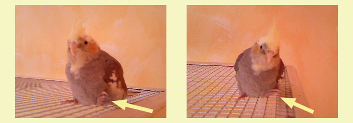 Die Fußfehlstellung von Nanda. Nanda's linker Fuß stand nach außen ab.